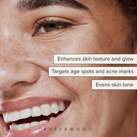 Close-up of a smiling freckled face with callouts: enhances skin texture and glow, targets age spots and acne marks, evens skin tone.
