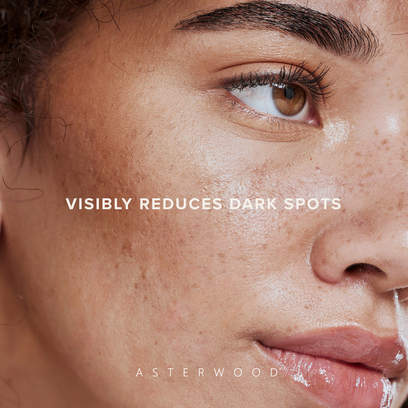 Close-up of a woman with curly hair and freckled skin under headline 'visibly reduces dark spots', illustrating Dark Spot Corrector results.