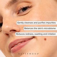 Close-up of a woman's skin with a small blemish near her lip, callouts: gently cleanses and purifies impurities, balances the skin's microbiome, reduces redness, swelling, and irritation.