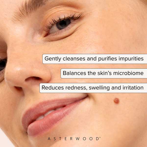 Close-up of a woman's skin with a small blemish near her lip, callouts: gently cleanses and purifies impurities, balances the skin's microbiome, reduces redness, swelling, and irritation.